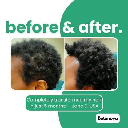 Butanova™ - Raw Batana Oil