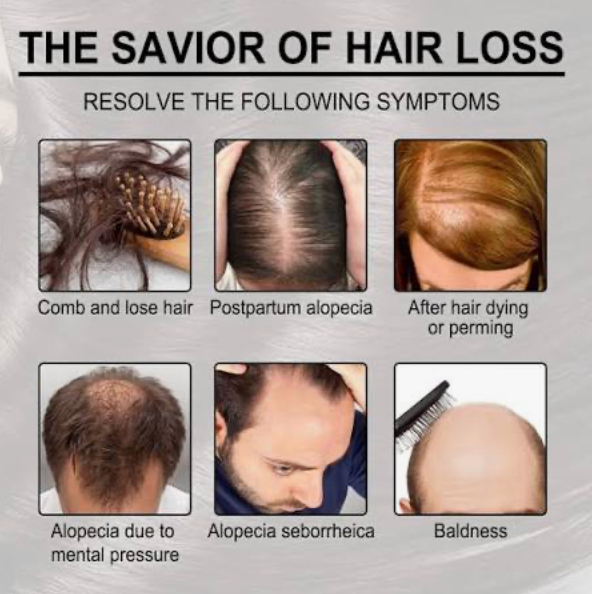 Butanova™ - Raw Batana Oil